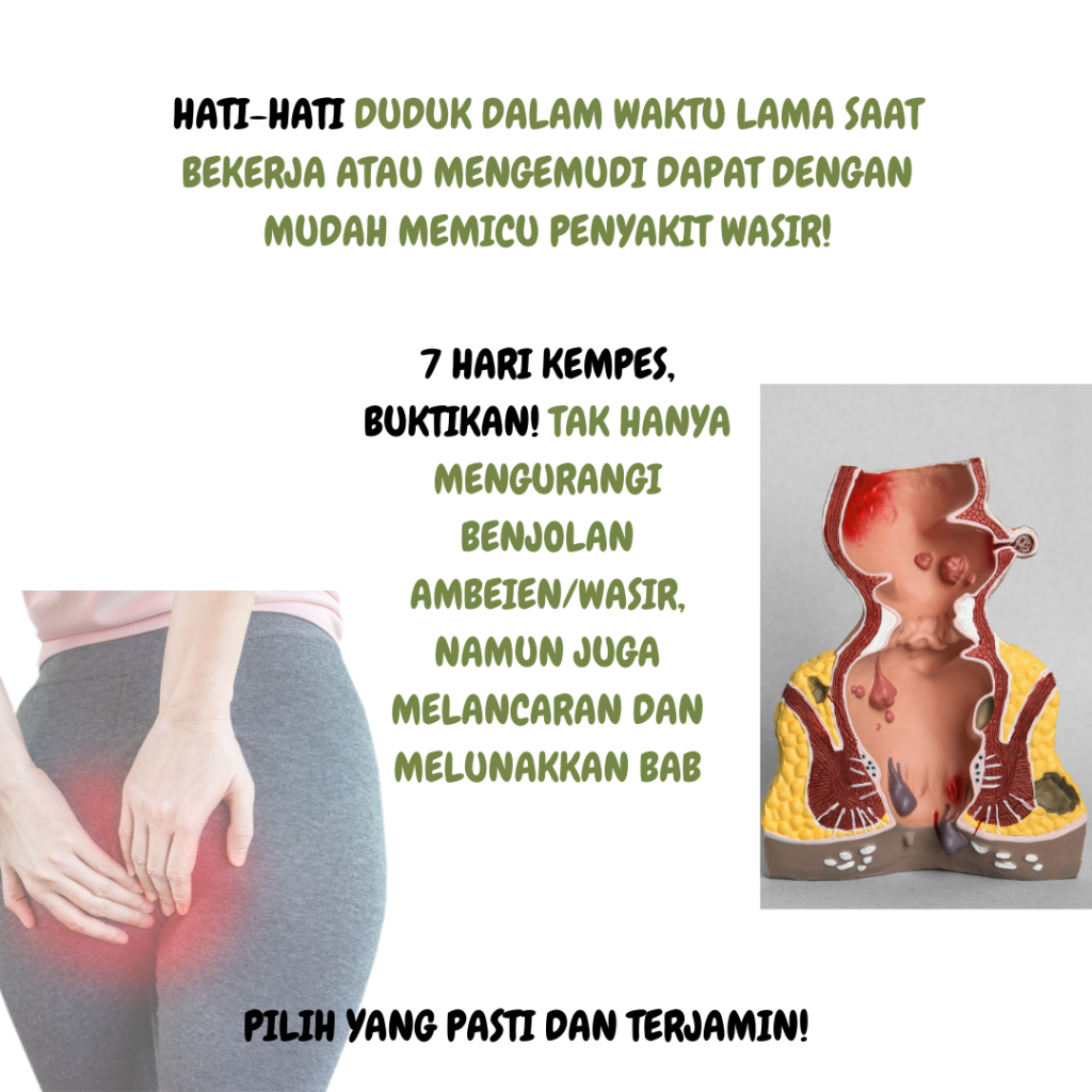Gejala Wasir